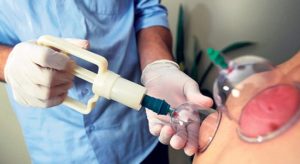 Hacamat Tedavisi- Havalı Hacamat (air cupping) Hacamat tedavisi havalı