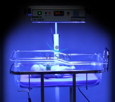 egzama için fototerapi alan bebek