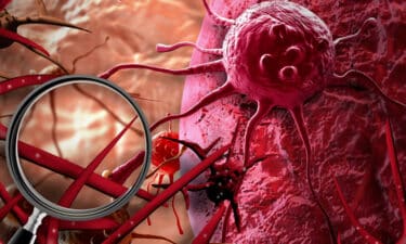 Kanser Hücresinin Sırrı Çözüldü. Hücre Genetiğine Yönelik Tedaviler