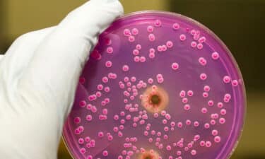 Candida Mantarı Nedir? Belirtileri ve Tedavisi Nelerdir? Nasıl Beslenmeli?