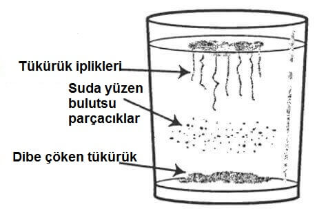 Candida Mantarı Testi Nasıl Yapılır?