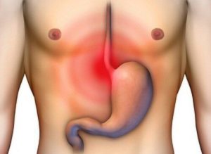 mide yanmasi neden olur mide yanmasina neler iyi gelir