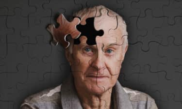 Alzheimer Hastalığı