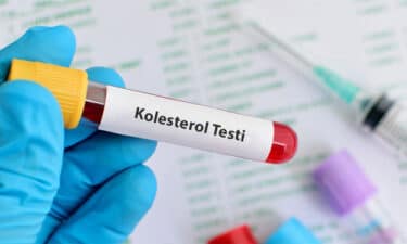 kolesterol tahlili tüpü