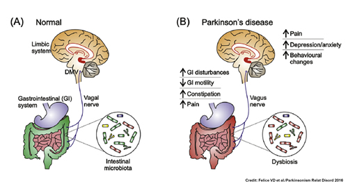 Prebiyotik ve parkinson