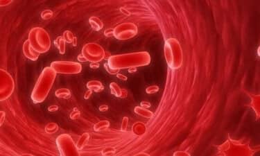 Anemi Hastaligi Nedir Belirtileri Cesitleri Tedavisi