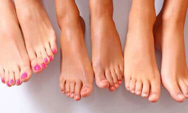 Tırnak Mantarı Nedir? Tırnak Mantarı Tedavisi Nasıl Yapılır? Doğal İlaçlar