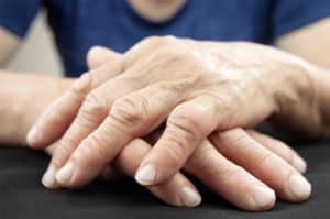 Romatoid Artrit: Romatizmal Ağrılarda Doğal ve Bitkisel Tedaviler