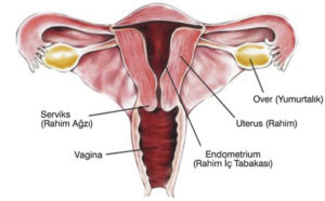 Endometriozis ve endometrium nedir