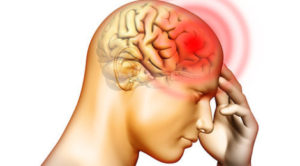 migren ağrısı görseli