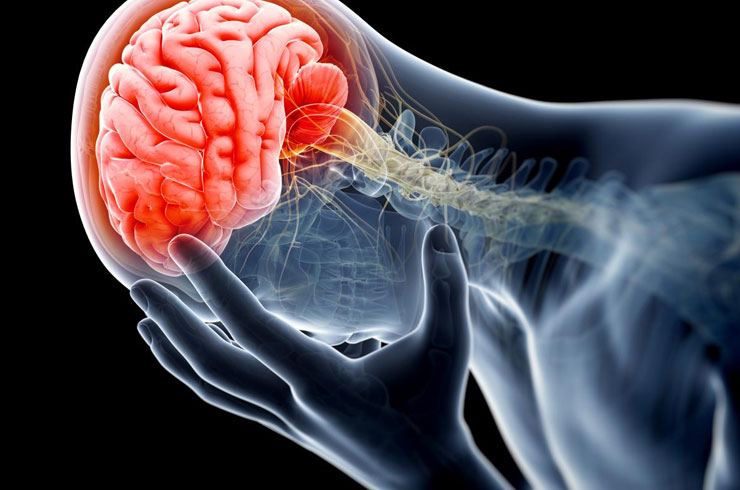 Beyin Tümörü Nedir? Beyin Tümörü Belirtileri ve Nedenleri Nelerdir?