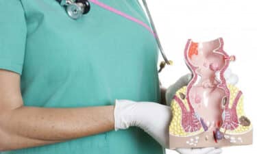 Hemoroid (Basur) Nedir? Belirtileri, Nedenleri ve Hemoroid Tedavisi