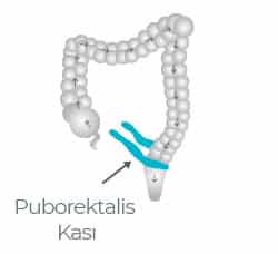 dışkılama ve Puborektails kası 