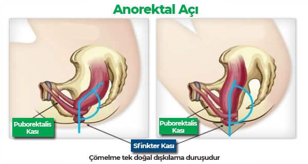 dışkılama için doğru anorektal açı