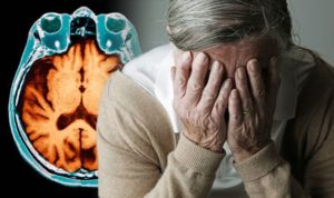 Alzheimer Hastalığı Nedenleri