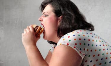 Obezite Nedir? Obezite Belirtileri ve Nedenleri Nelerdir? Nasıl Önlenir