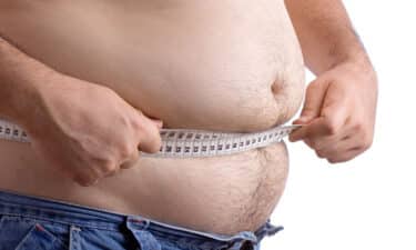 Obezite Nedir? Nasıl Teşhis Edilir? Tedavi Seçenekleri Nelerdir?