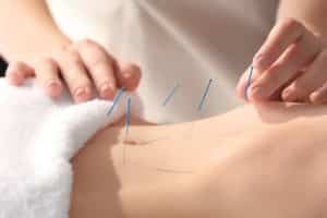 ağrılı adet ve akupunktur