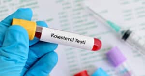 Kolesterol testi